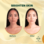 turmeric soap benefits for face