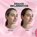 beetroot soap benefits